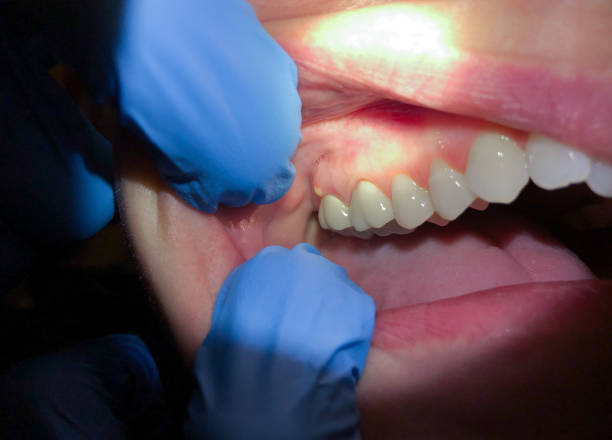 Best Weekend Emergency Dentist in Wilkinson Heights, SC